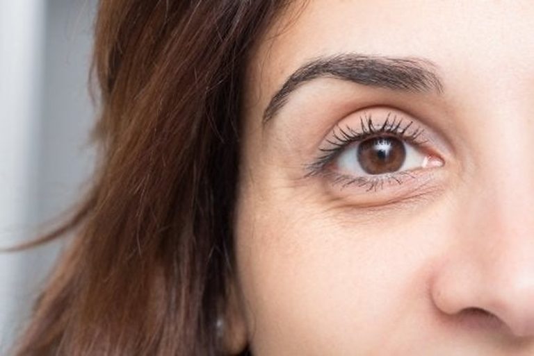 ¿Por qué tenemos ojeras?: causas y soluciones