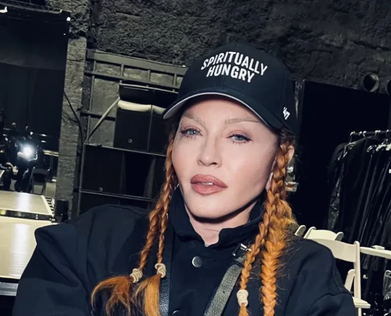 Madonna sube una foto de su rostro «después de su cirugía»