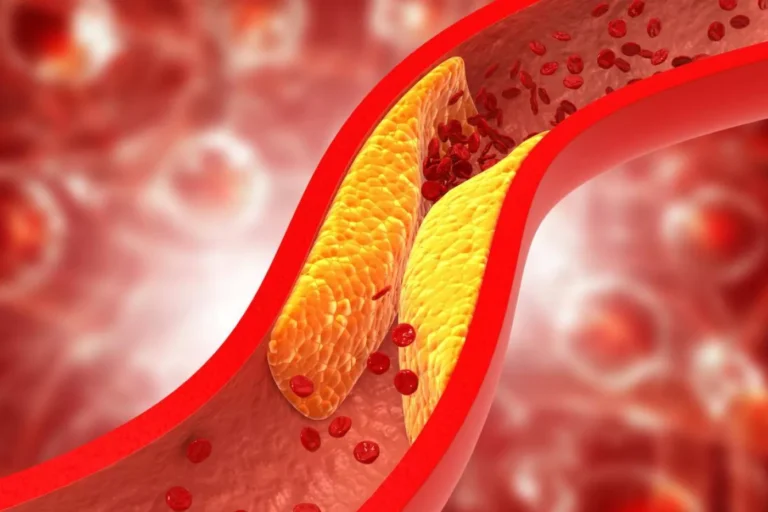 Colesterol HDL, undesafío nutricional