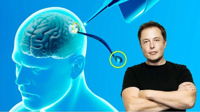 Elon Musk anunció que Neuralink implantó por primera vez un chip cerebral en un ser humano